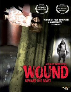 WOUND